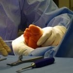 How Does Metal-Free Foot Surgery Change Recovery? image