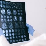 What Families Should Know When a Loved One Might Have CTE What Families Should Know When a Loved One Might Have CTE